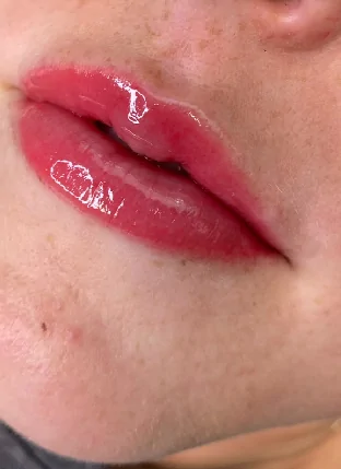 Renew Beauty PMU lip blush